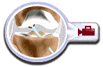 Anteriour Cruciate Ligament ACL Reconstruction
