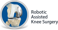 Robotic Assisted Knee Replacement