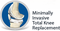 Computer Assisted Joint Replacement