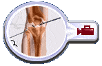 Knee Arthroscopy Adelaide