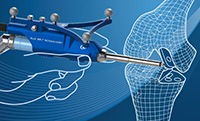 Nivo Handpiece Cut Mesh